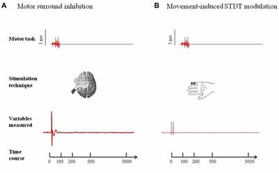 Voluntary Movement Takes Shape: The Link Between Movement Focusing and Sensory Input Gating